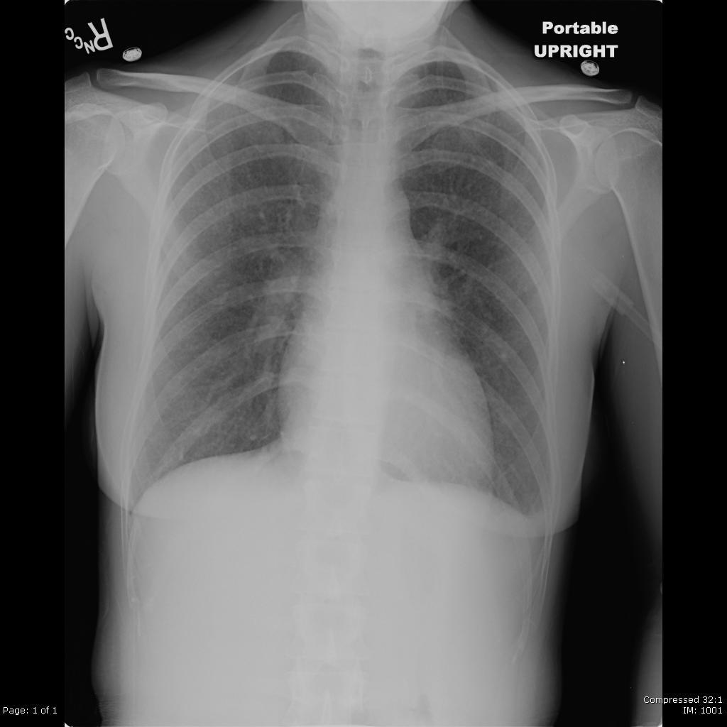figure 3a