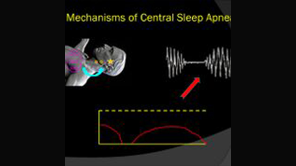 understanding-mechanisms-of-central-sleep-apnea