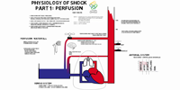 Shock: Perfusion